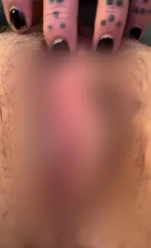 reddit content